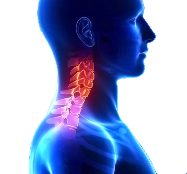 cervicalgie